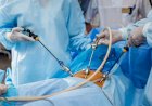 SES amplia acesso à cirurgia bariátrica em MS com triagem criteriosa e novas referências