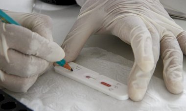 MS registra 275 novos casos de covid na primeira semana epidemiológica do ano