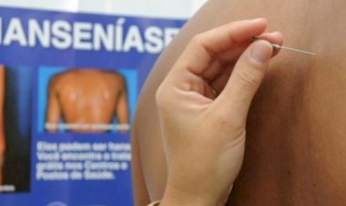 Saúde realiza ações de enfrentamento à hanseníase