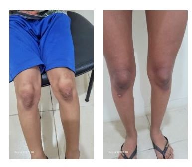 Mãe e madrasta são presas por tortura contra adolescente e criança em Coxim